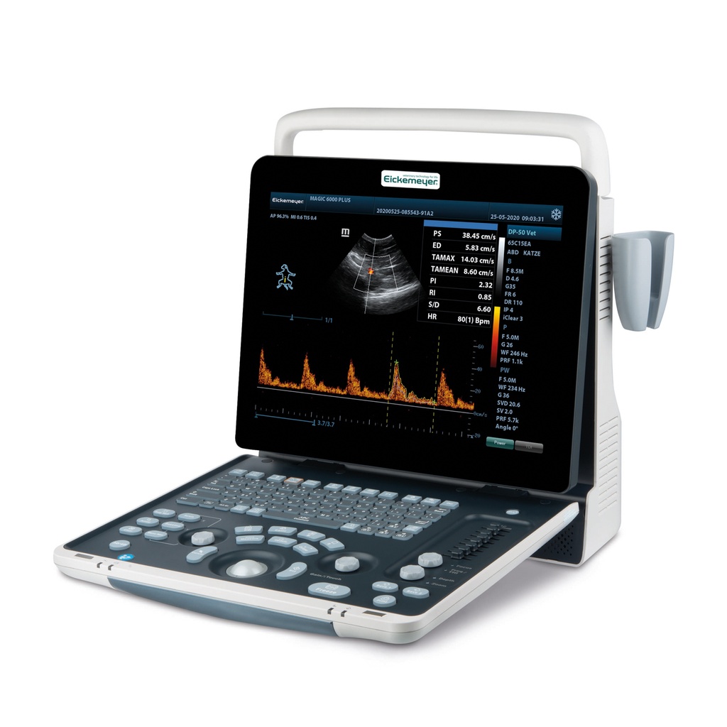 303740 MAGIC 6000 PLUS + 2 probes of your choice (303710, 303711, 304021) + 12x 303936 EICKEMEYER® ultrasound gel
