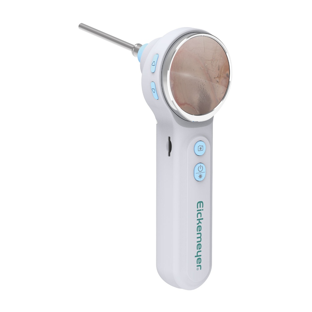 EickView OTO - Digital Video Otoscope