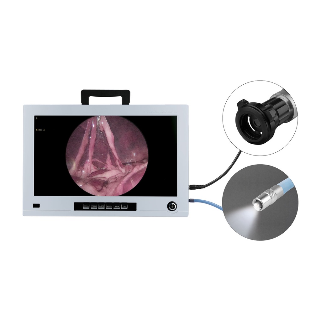 Clearance Set: EickView 4-in-1 Endoscopy Monitor incl. a high-resolution CCD camera and LED cold light source + Eickview Compact