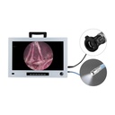 Clearance Set: EickView 4-in-1 Endoscopy Monitor incl. a high-resolution CCD camera and LED cold light source + Eickview Compact