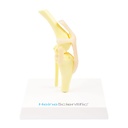 Osteo model type: Knee (new model)