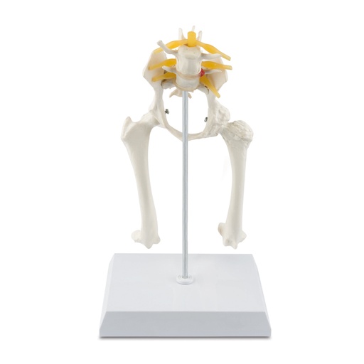 [909037] Osteo model type: hip  